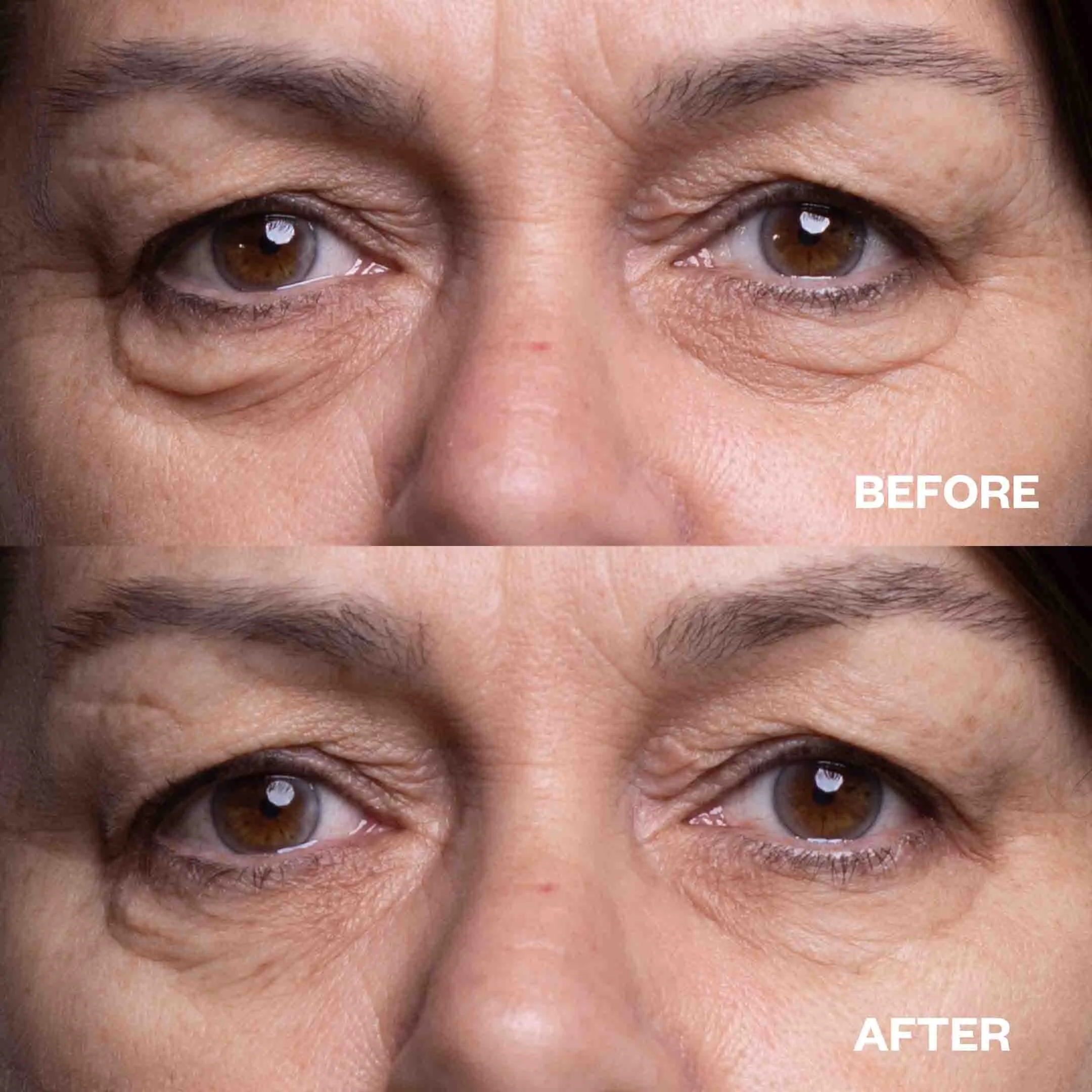My Wrinkles Are Out of Office Bundle